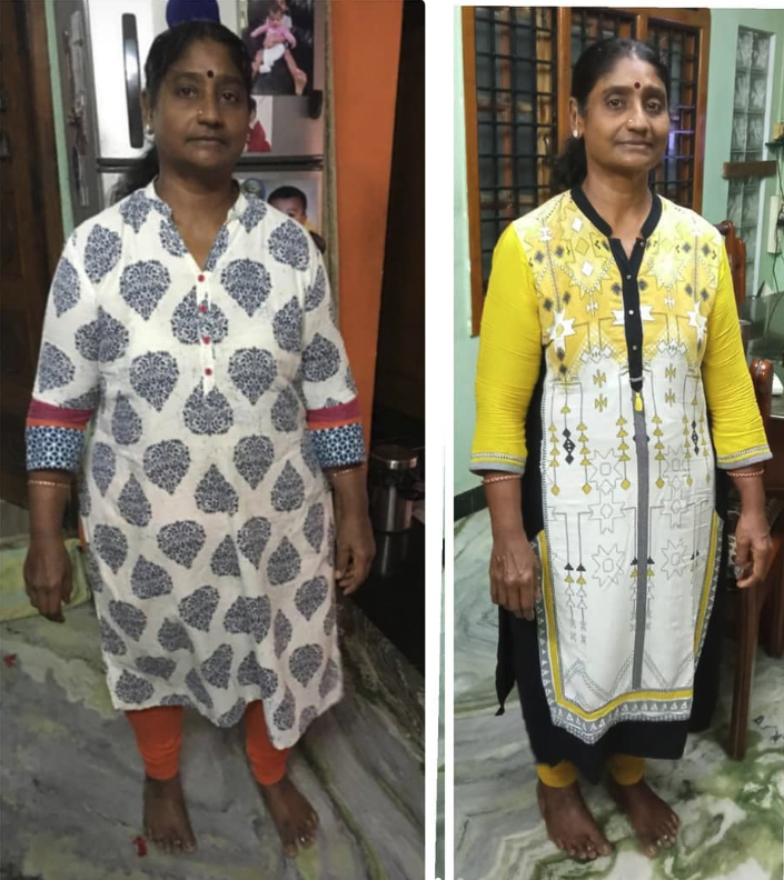 Kalai's weight loss transformation